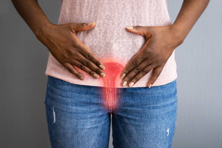 Vulvodynia a woman with pain in her vulva and vagina